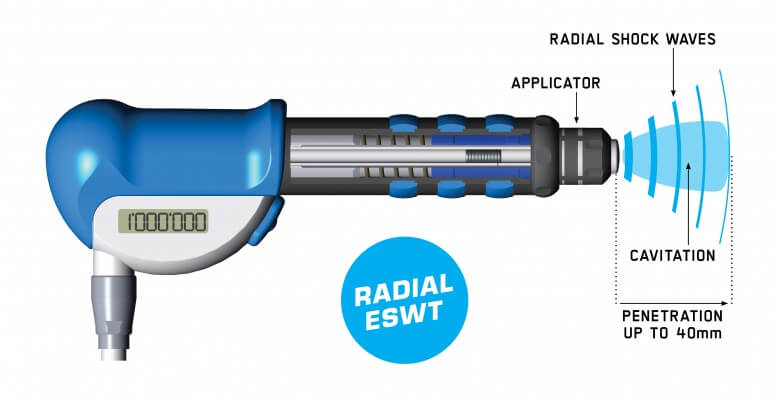 EMS_SDC-Radial_776x400px_Radial_Handpieces_new Shockwave Therapy Machine