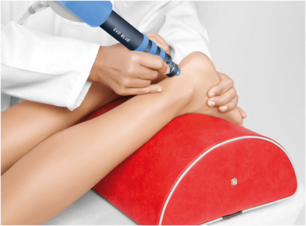 Insertional Achilles tendinopathy4 Patient receiving Shockwave Therapy treatment for a tendon injury